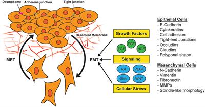 Behind the Wheel of Epithelial Plasticity in KRAS-Driven Cancers